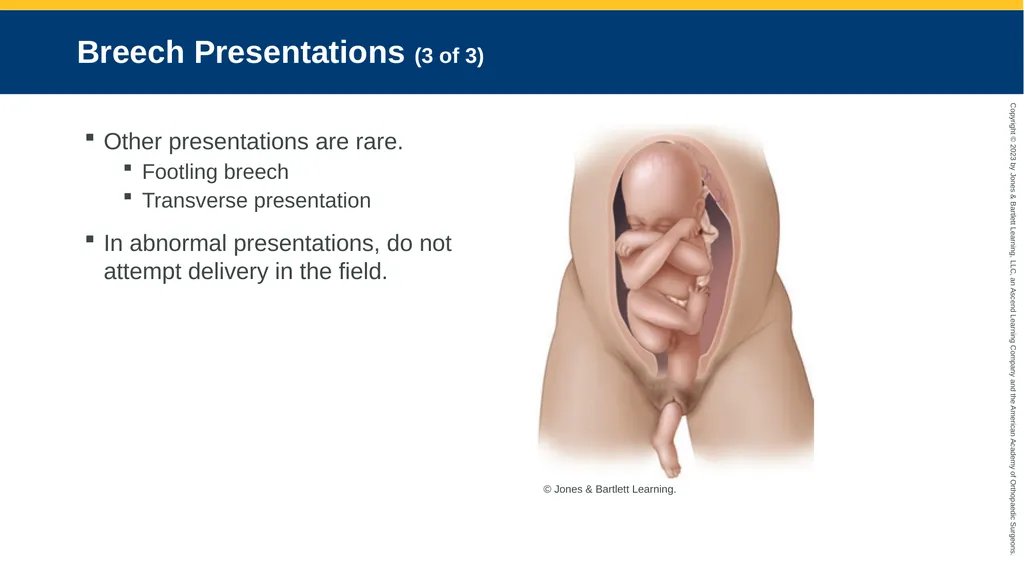 Obstetrics CHAPTER 42 Introduction Pregnancy is - slide 153 of 182