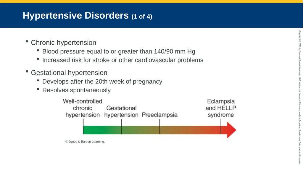 Obstetrics CHAPTER 42 Introduction Pregnancy is - slide 61 of 182
