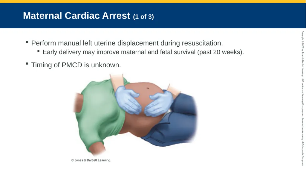 Obstetrics CHAPTER 42 Introduction Pregnancy is - slide 180 of 182