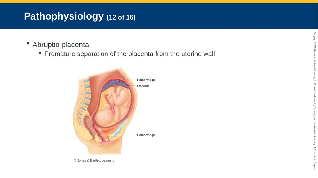 Obstetrics CHAPTER 42 Introduction Pregnancy is - slide 94 of 182