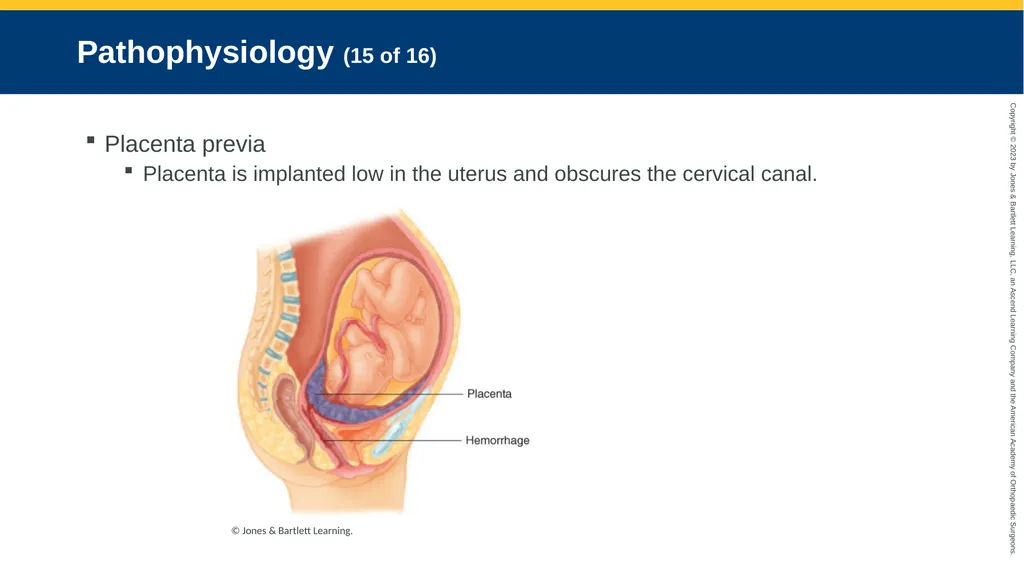 Obstetrics CHAPTER 42 Introduction Pregnancy is - slide 97 of 182