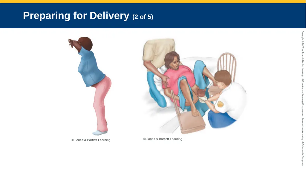 Obstetrics CHAPTER 42 Introduction Pregnancy is - slide 108 of 182