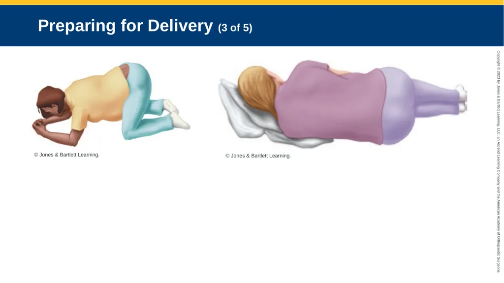 Obstetrics CHAPTER 42 Introduction Pregnancy is - slide 109 of 182