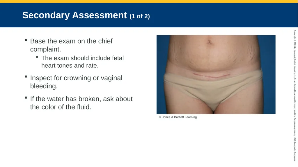 Obstetrics CHAPTER 42 Introduction Pregnancy is - slide 49 of 182