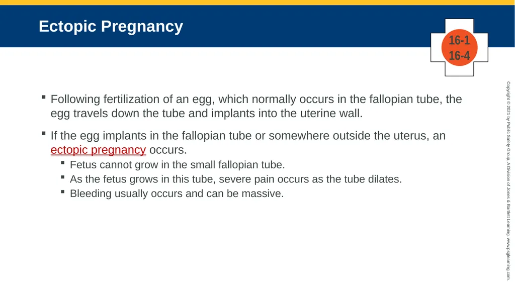 CHAPTER 16 Gastrointestinal, Genitourinary, and - slide 45 of 74