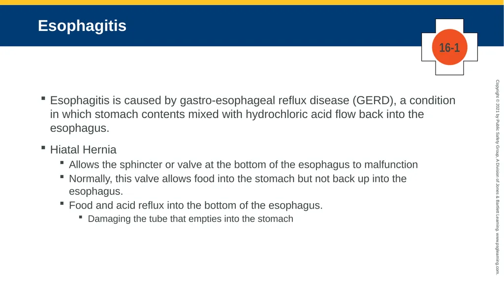 CHAPTER 16 Gastrointestinal, Genitourinary, and - slide 39 of 74