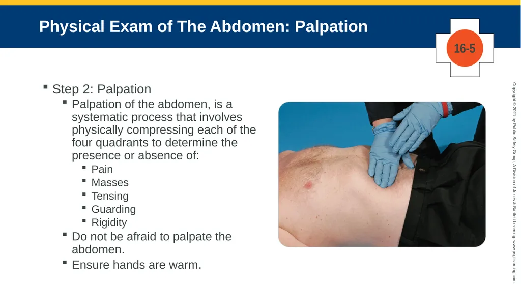 CHAPTER 16 Gastrointestinal, Genitourinary, and - slide 62 of 74
