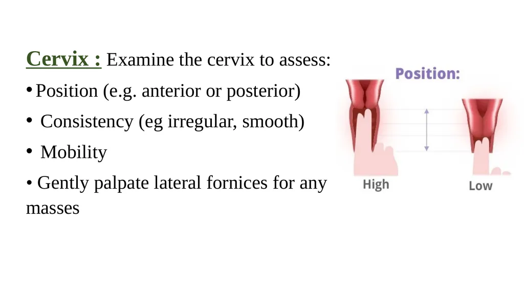 Bimanual pelvic examination Prepared by: Shaimaa - slide 13 of 22