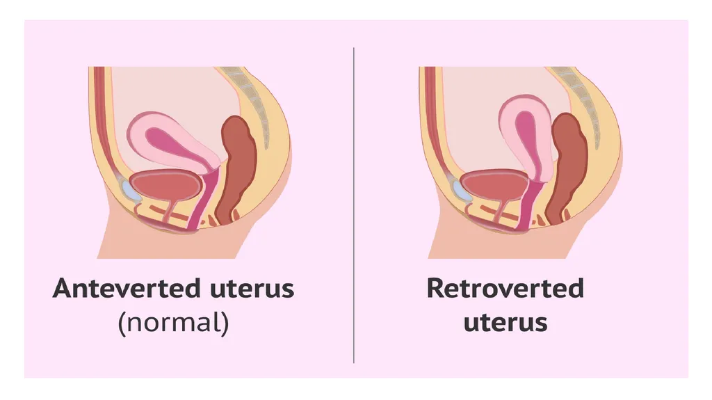 Bimanual pelvic examination Prepared by: Shaimaa - slide 19 of 22