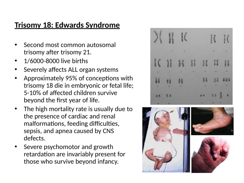 Chromosomal Aberrations Chromosomes contain units - slide 9 of 21