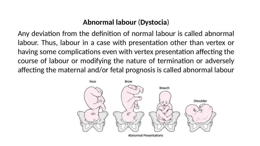 Normal Labour Introduction The usual duration of - slide 10 of 39