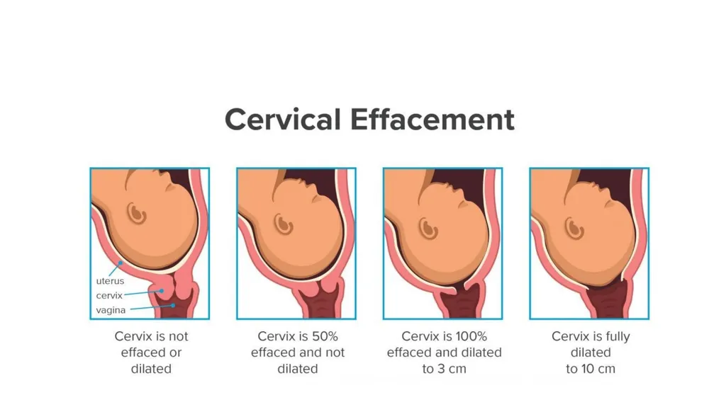 Normal Labour Introduction The usual duration of - slide 32 of 39