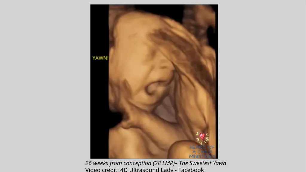 Month 7 Weeks 23-26 after Conception Blinking - slide 5 of 8
