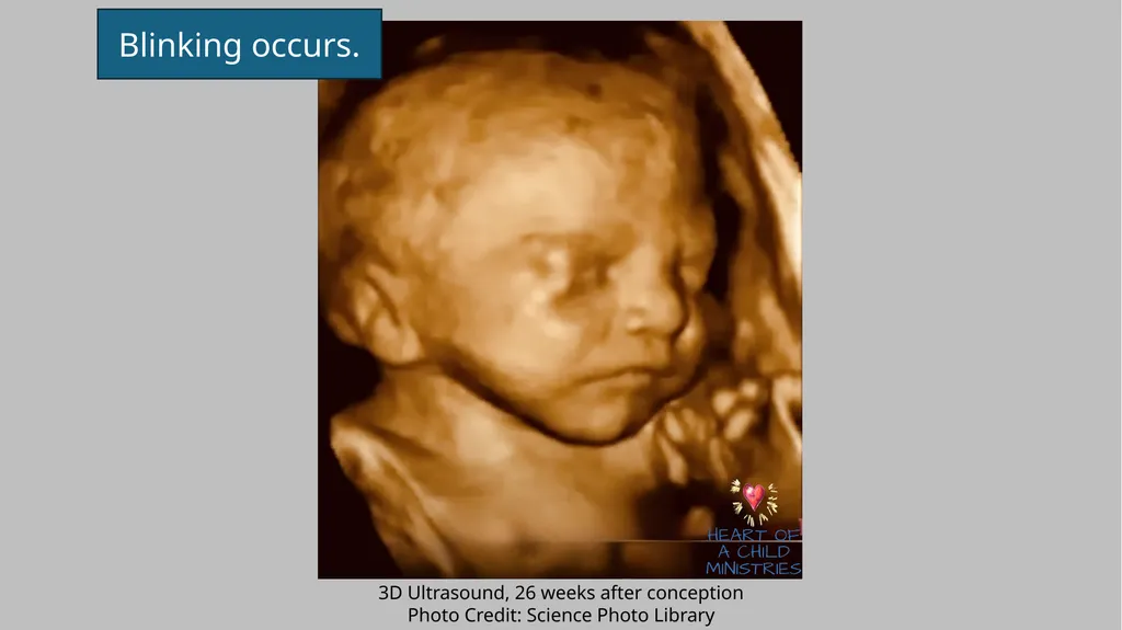 Month 7 Weeks 23-26 after Conception Blinking - slide 2 of 8