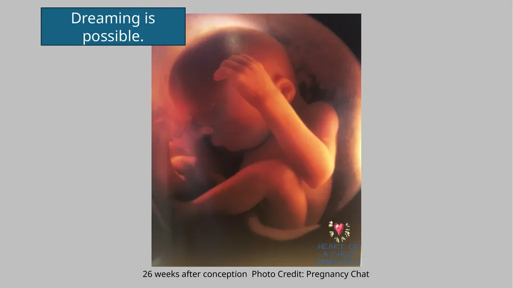 Month 7 Weeks 23-26 after Conception Blinking - slide 4 of 8