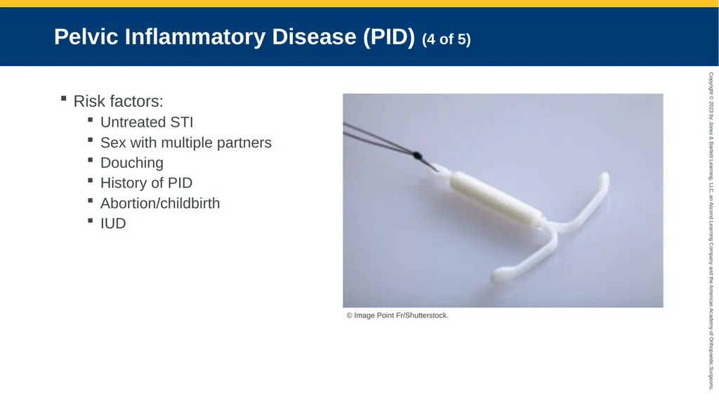 Gynecologic Emergencies CHAPTER 23 Introduction - slide 33 of 80