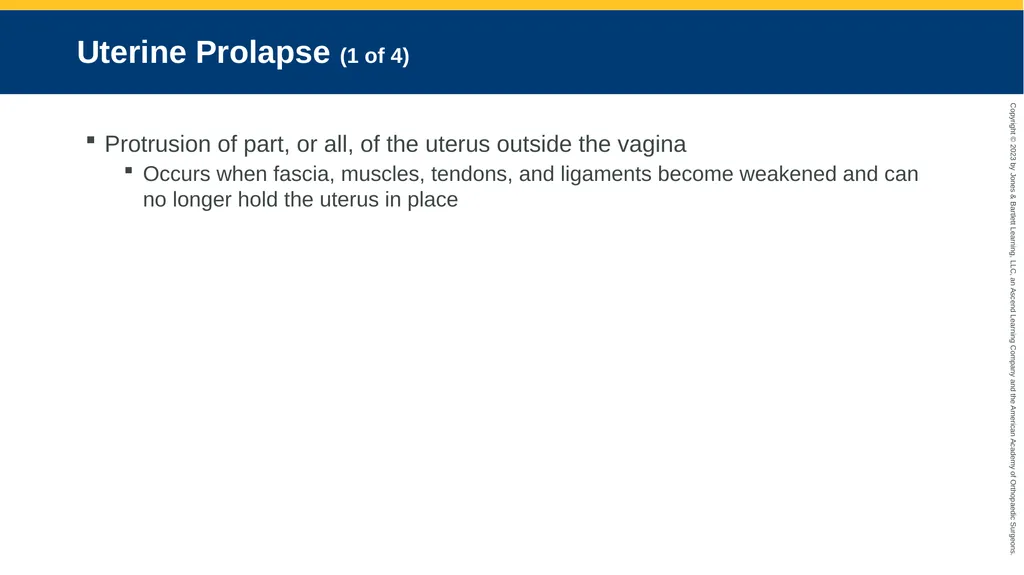 Gynecologic Emergencies CHAPTER 23 Introduction - slide 55 of 80