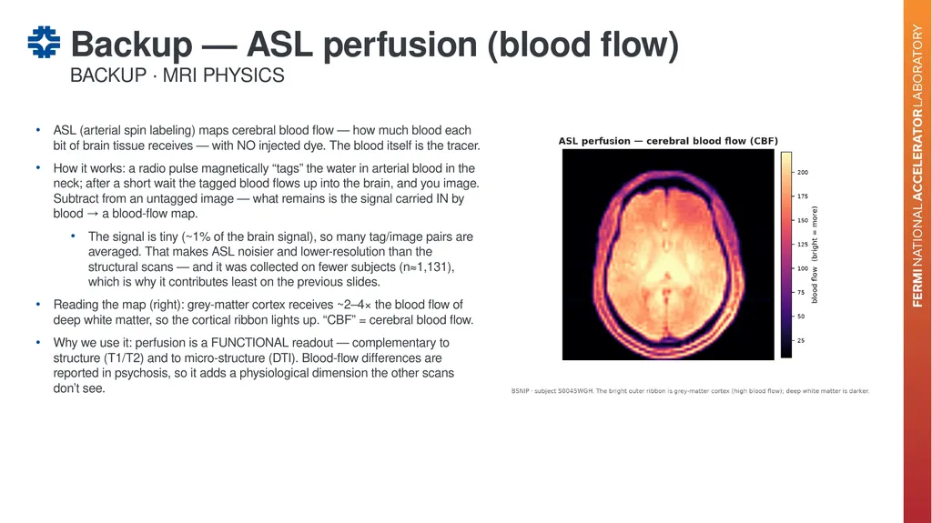 Can a brain-imaging foundation model see - slide 44 of 48