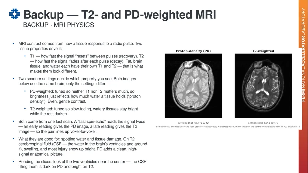 Can a brain-imaging foundation model see - slide 42 of 48