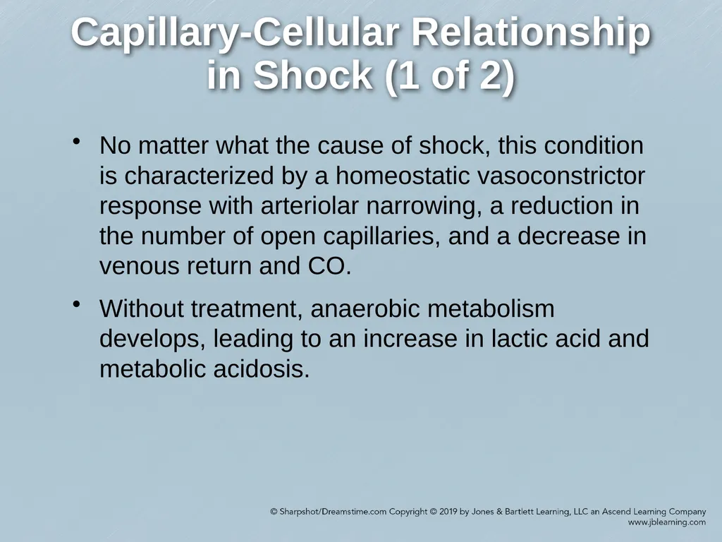 Chapter 35 Shock Comprehensive Lecture National - slide 17 of 59