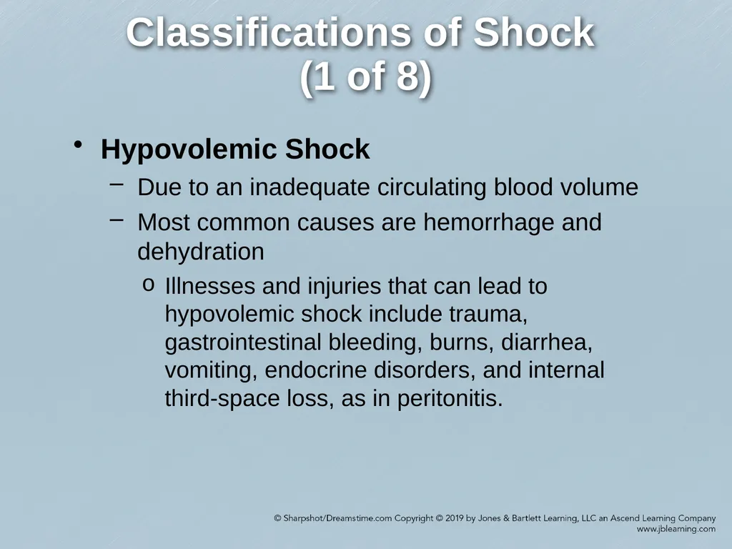 Chapter 35 Shock Comprehensive Lecture National - slide 19 of 59