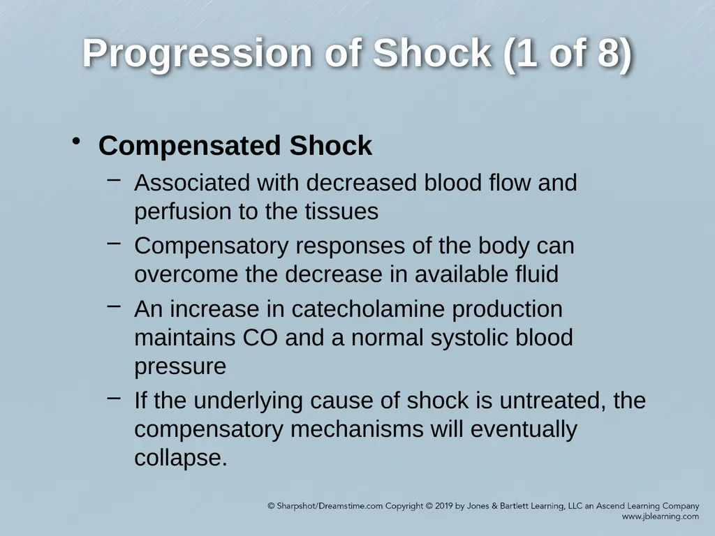 Chapter 35 Shock Comprehensive Lecture National - slide 27 of 59