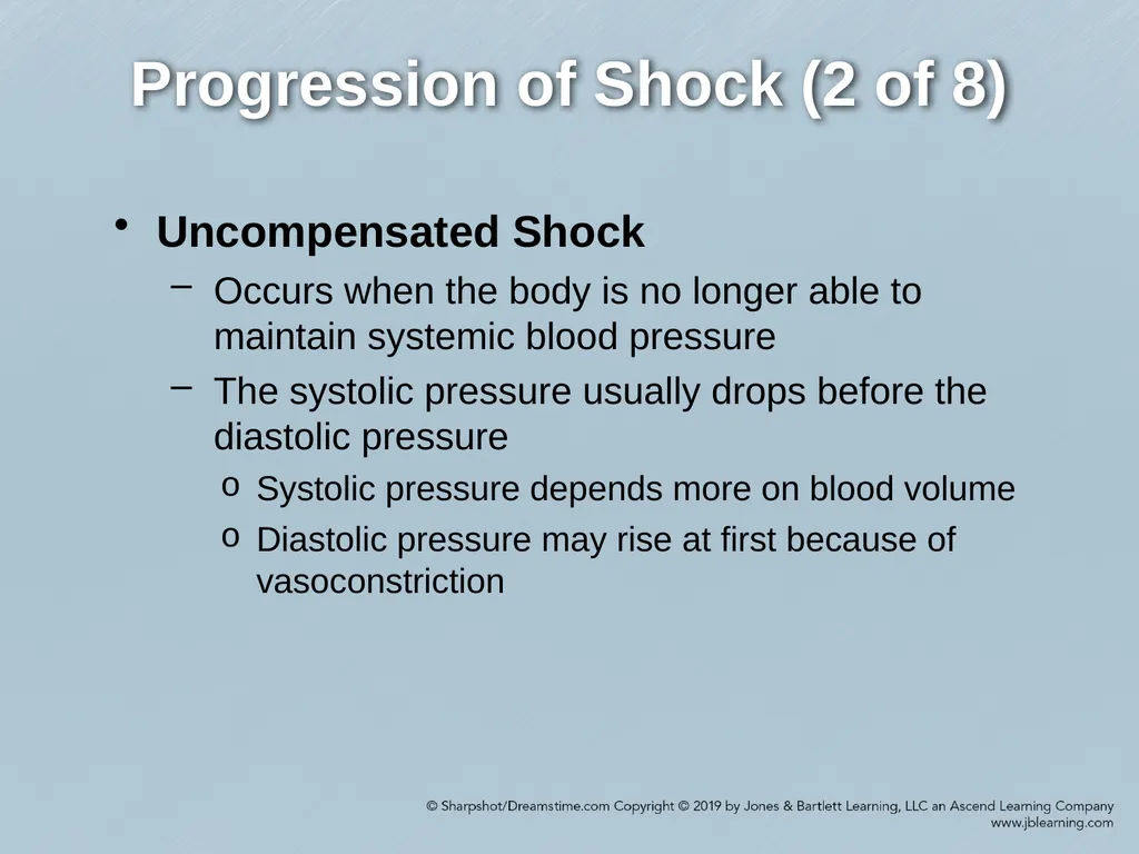 Chapter 35 Shock Comprehensive Lecture National - slide 28 of 59