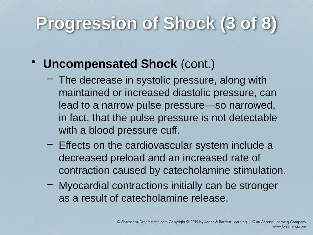 Chapter 35 Shock Comprehensive Lecture National - slide 29 of 59