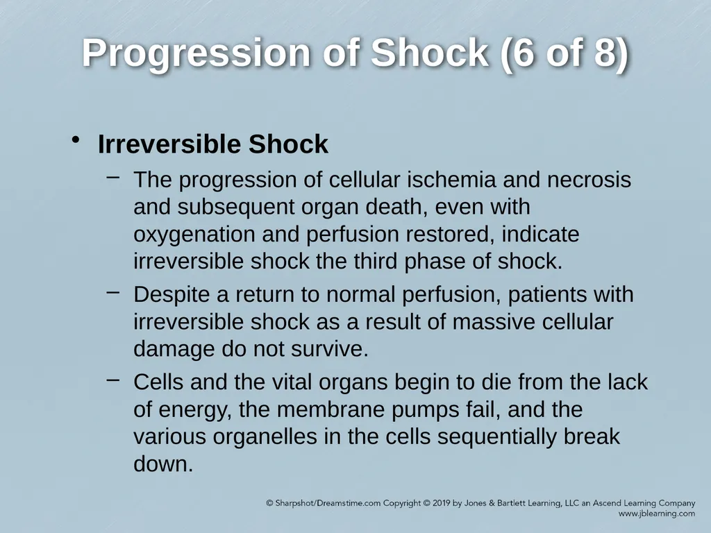 Chapter 35 Shock Comprehensive Lecture National - slide 32 of 59