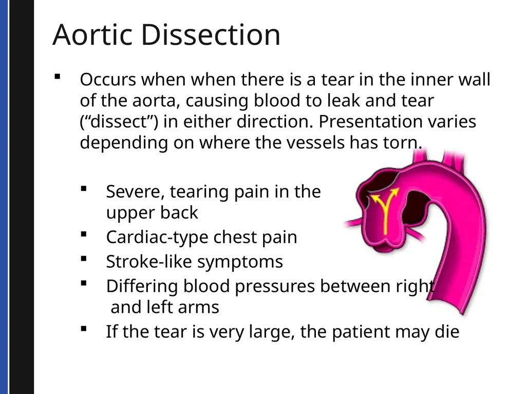 BLS 2015 Cardiovascular Emergencies Cardiovascular - slide 31 of 58