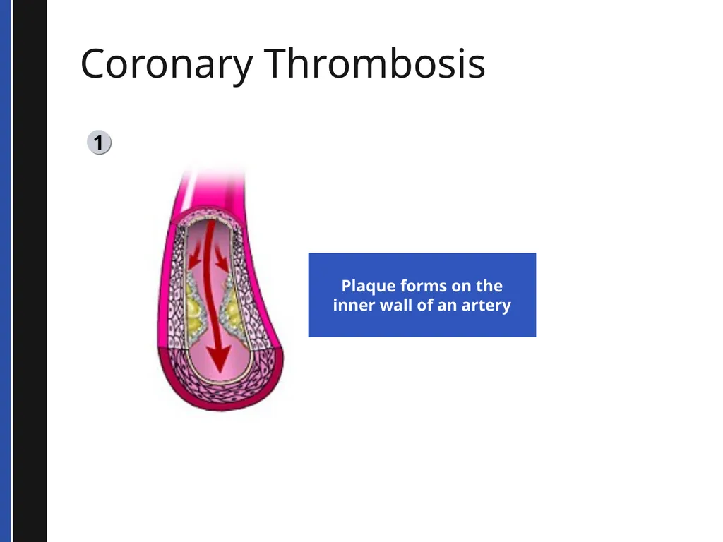 BLS 2015 Cardiovascular Emergencies Cardiovascular - slide 19 of 58