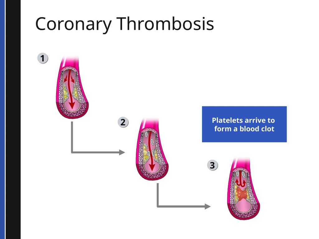 BLS 2015 Cardiovascular Emergencies Cardiovascular - slide 21 of 58