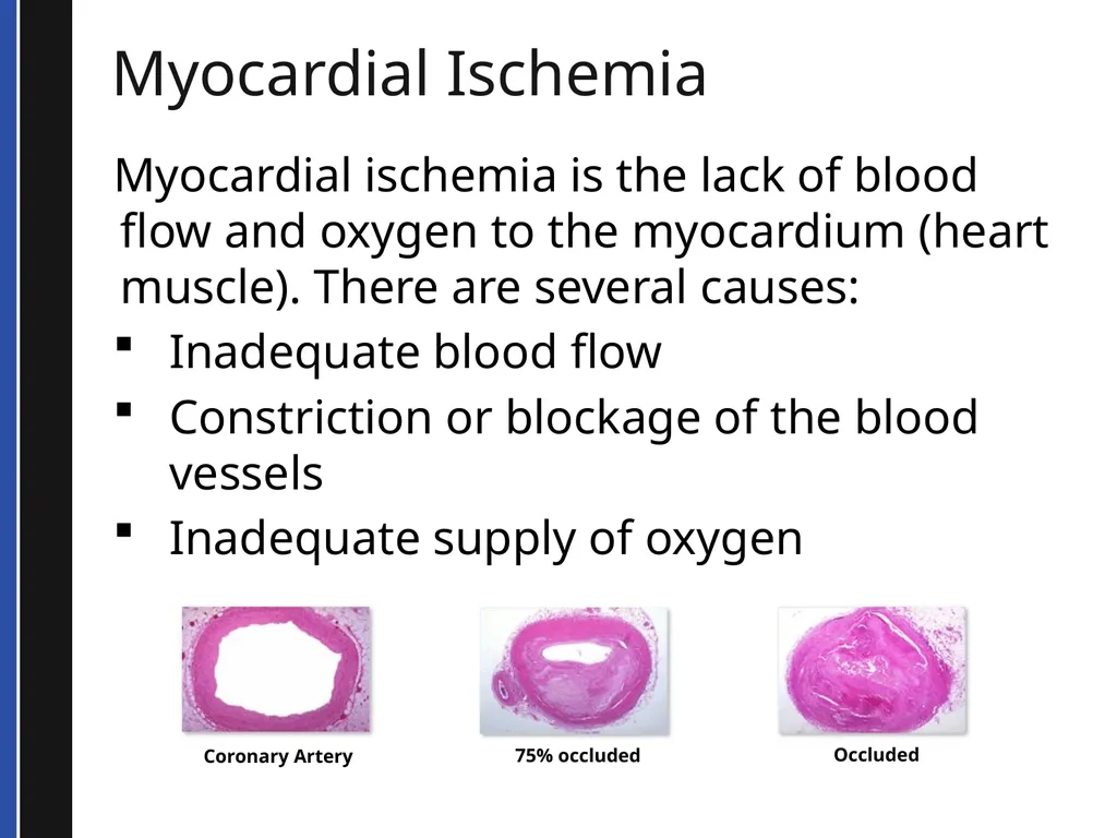 BLS 2015 Cardiovascular Emergencies Cardiovascular - slide 17 of 58