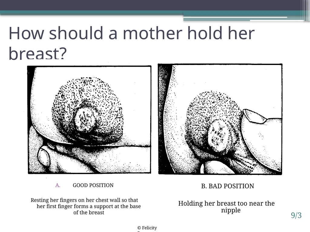 Session 9. Clinical practice: Positioning a baby - slide 3 of 5