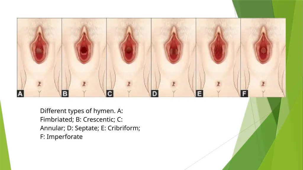 Virginity, sexual offenses and Perversions - slide 13 of 23