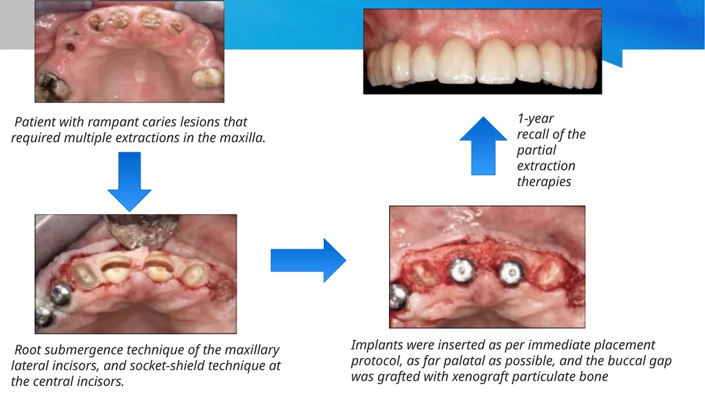 Partial Extraction Therapies (PET): Maintaining - slide 13 of 18