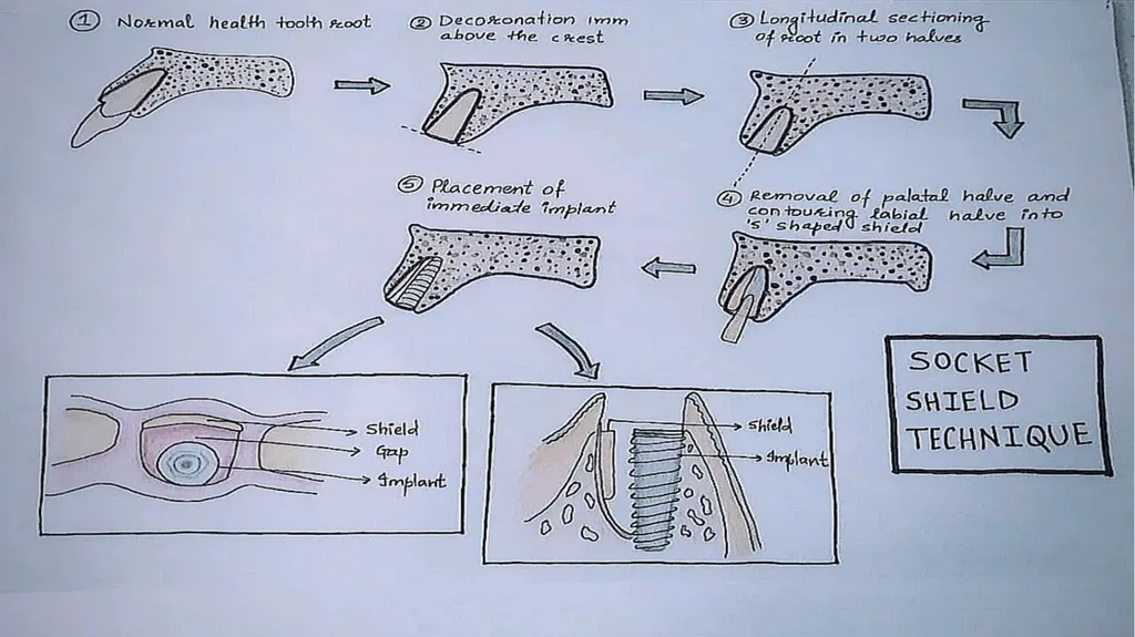 Partial Extraction Therapies (PET): Maintaining - slide 12 of 18