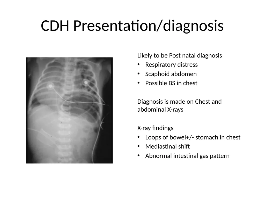 PREP Neonatal cases…. 2021 Helen Fielder Case 1 33 - slide 32 of 35