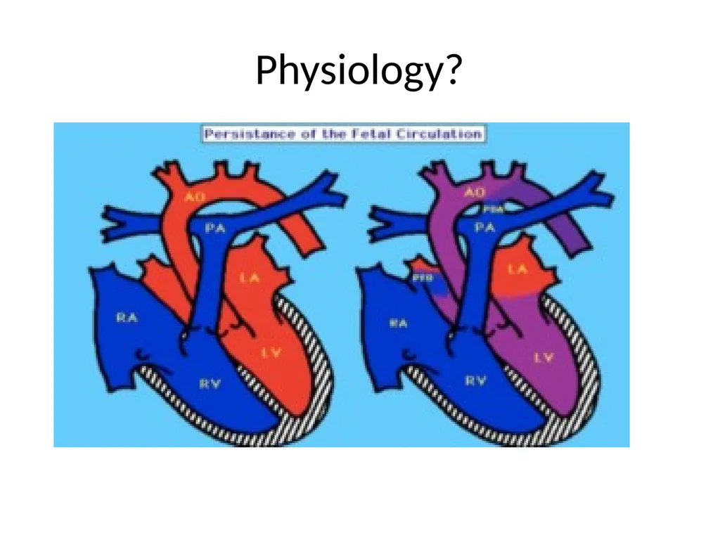PREP Neonatal cases…. 2021 Helen Fielder Case 1 33 - slide 13 of 35