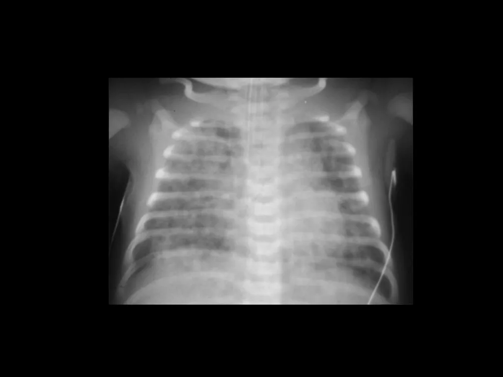 PREP Neonatal cases…. 2021 Helen Fielder Case 1 33 - slide 11 of 35