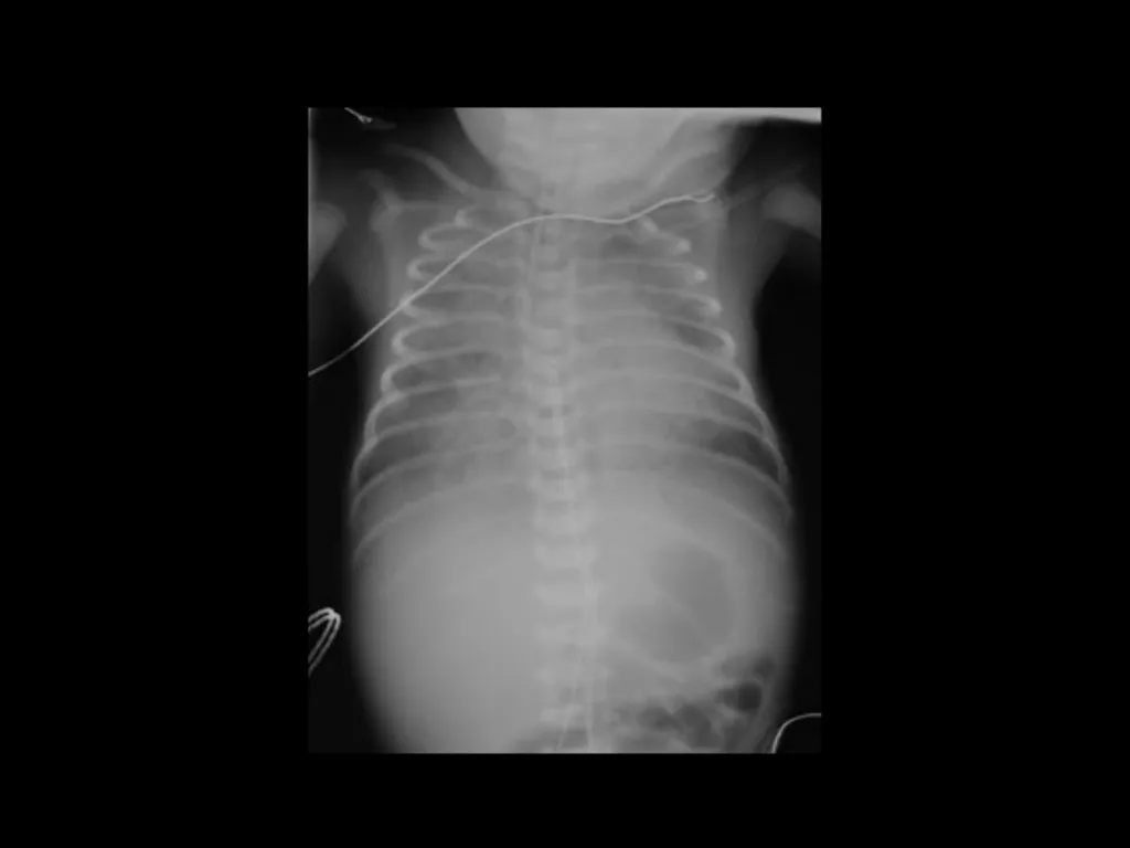 PREP Neonatal cases…. 2021 Helen Fielder Case 1 33 - slide 12 of 35