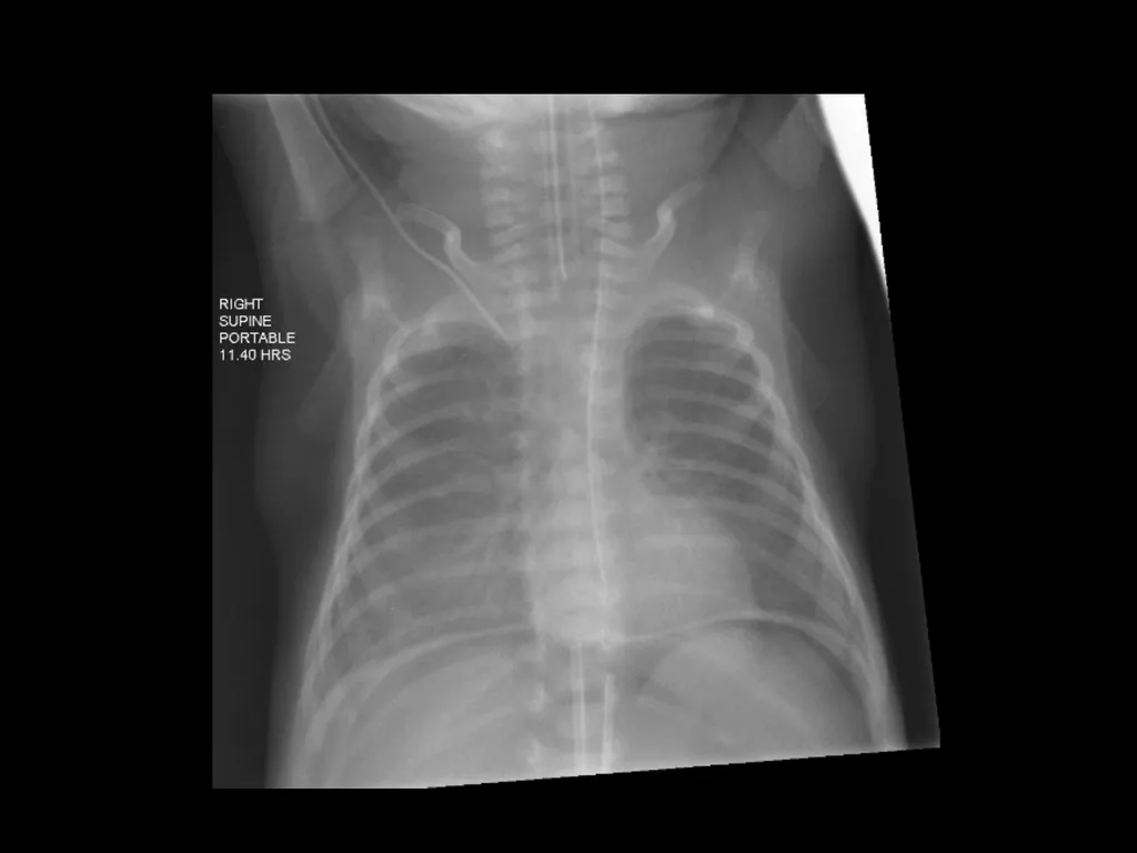 PREP Neonatal cases…. 2021 Helen Fielder Case 1 33 - slide 22 of 35