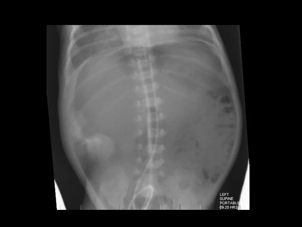 PREP Neonatal cases…. 2021 Helen Fielder Case 1 33 - slide 25 of 35