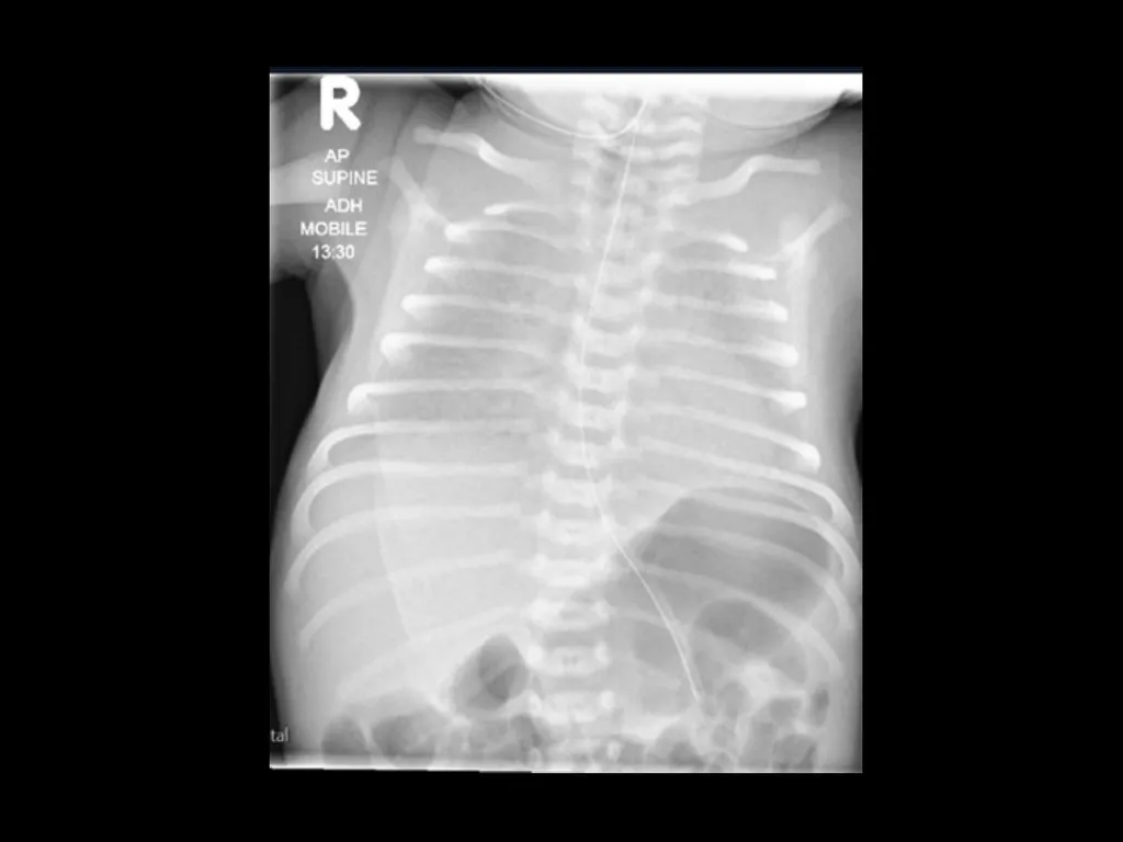 PREP Neonatal cases…. 2021 Helen Fielder Case 1 33 - slide 3 of 35