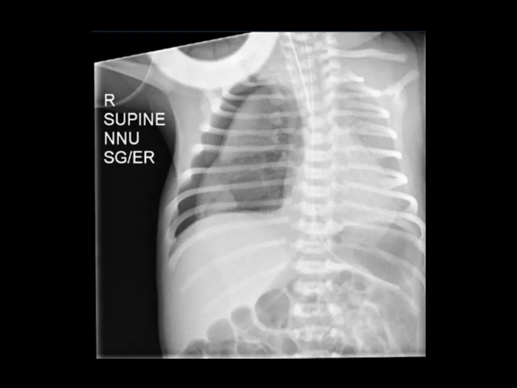 PREP Neonatal cases…. 2021 Helen Fielder Case 1 33 - slide 4 of 35