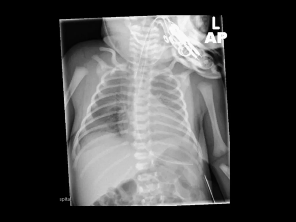 PREP Neonatal cases…. 2021 Helen Fielder Case 1 33 - slide 5 of 35