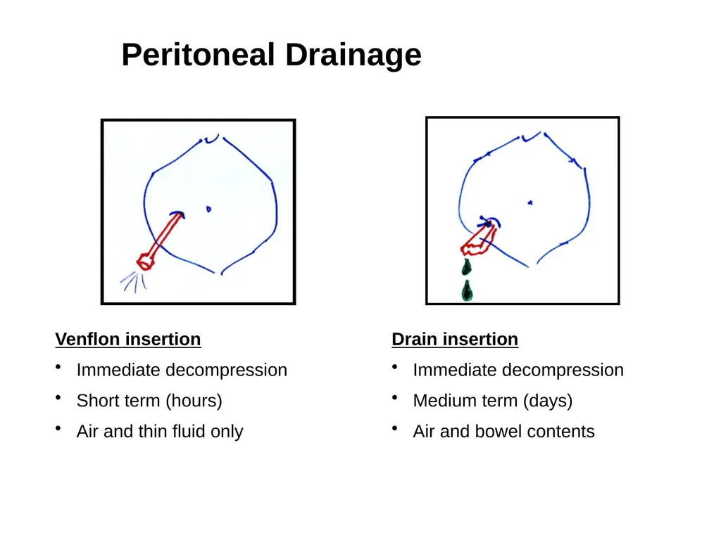 PREP Neonatal cases…. 2021 Helen Fielder Case 1 33 - slide 28 of 35