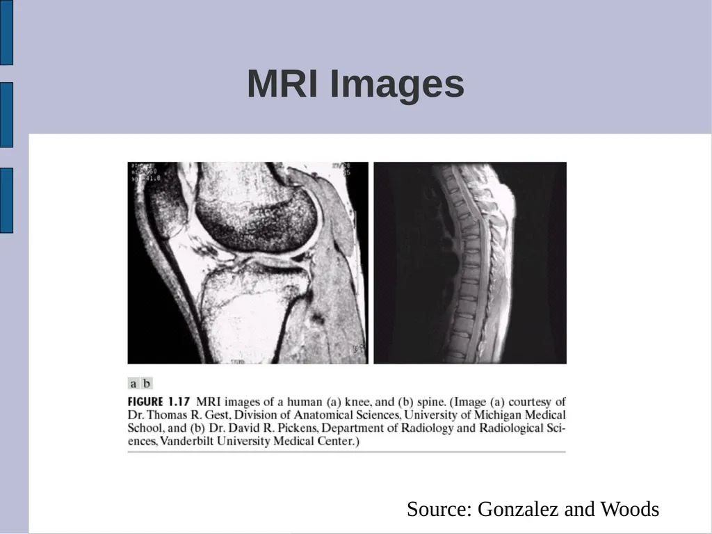 SYDE 575: Image Processing Introduction Read - slide 13 of 26