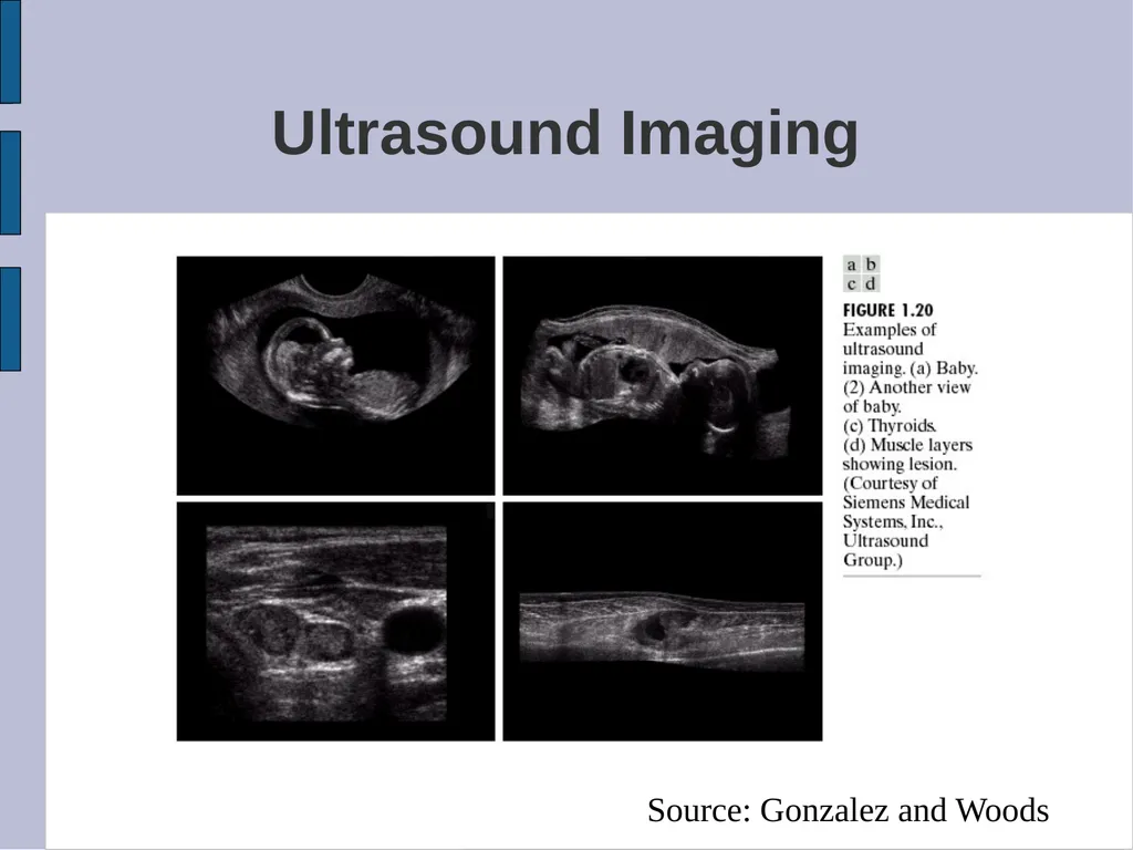 SYDE 575: Image Processing Introduction Read - slide 14 of 26