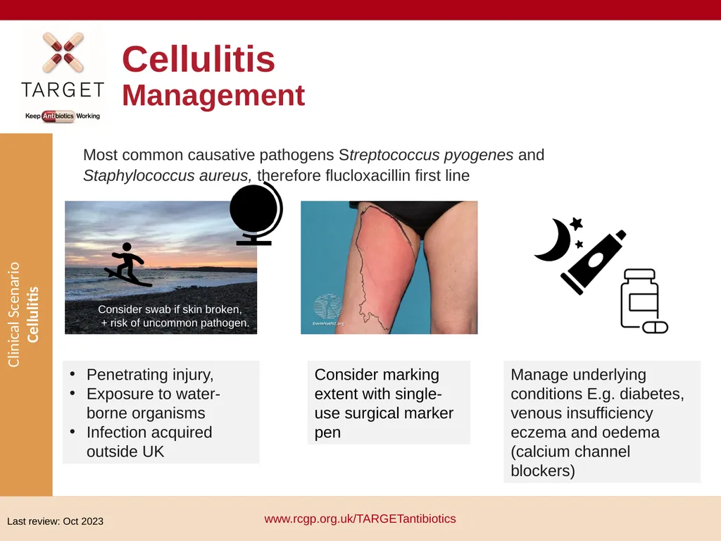 Clinical Scenario: Cellulitis People with dark - slide 9 of 17